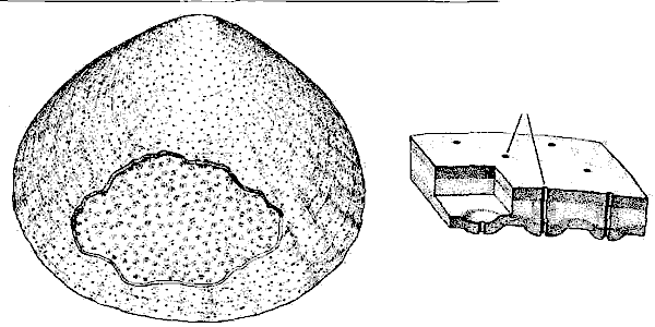 МНОГОЧИСЛЕННЫЕ ПОРЫ